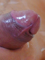 Emo Skater Twink With Uncut Cock and Big Balls